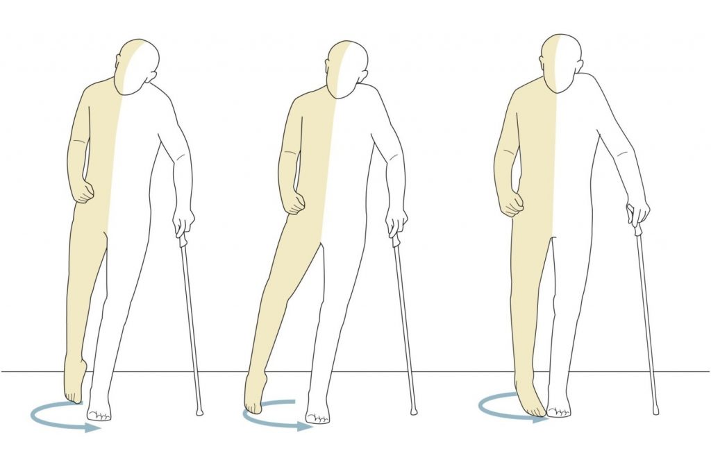 stroke mobility