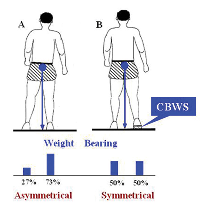 asymetric